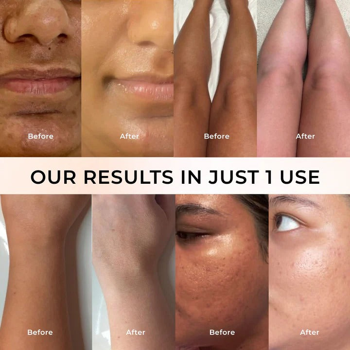 Unleash Your Radiance and Confidence Instantly!